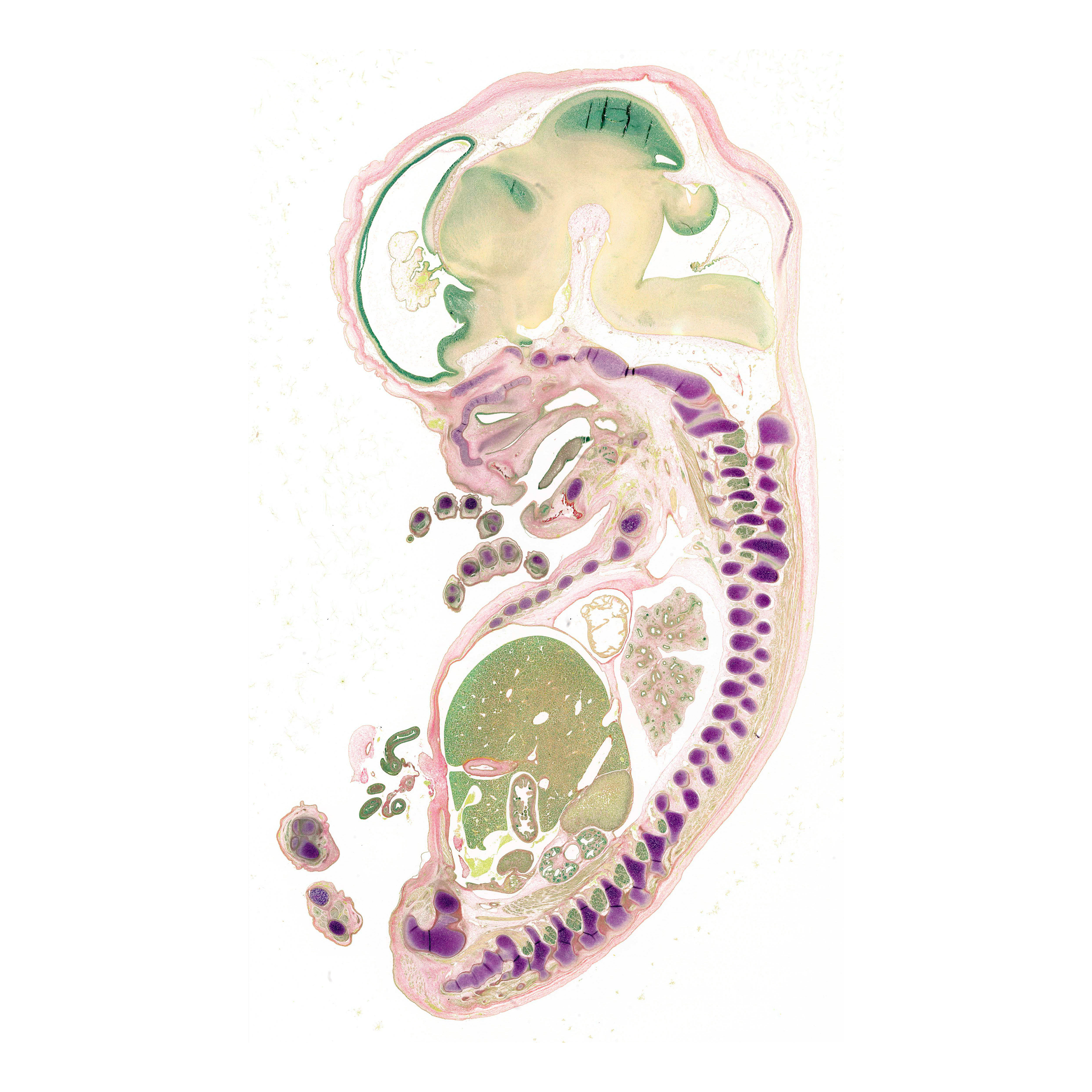 A pentachrome stained section of a human embryo