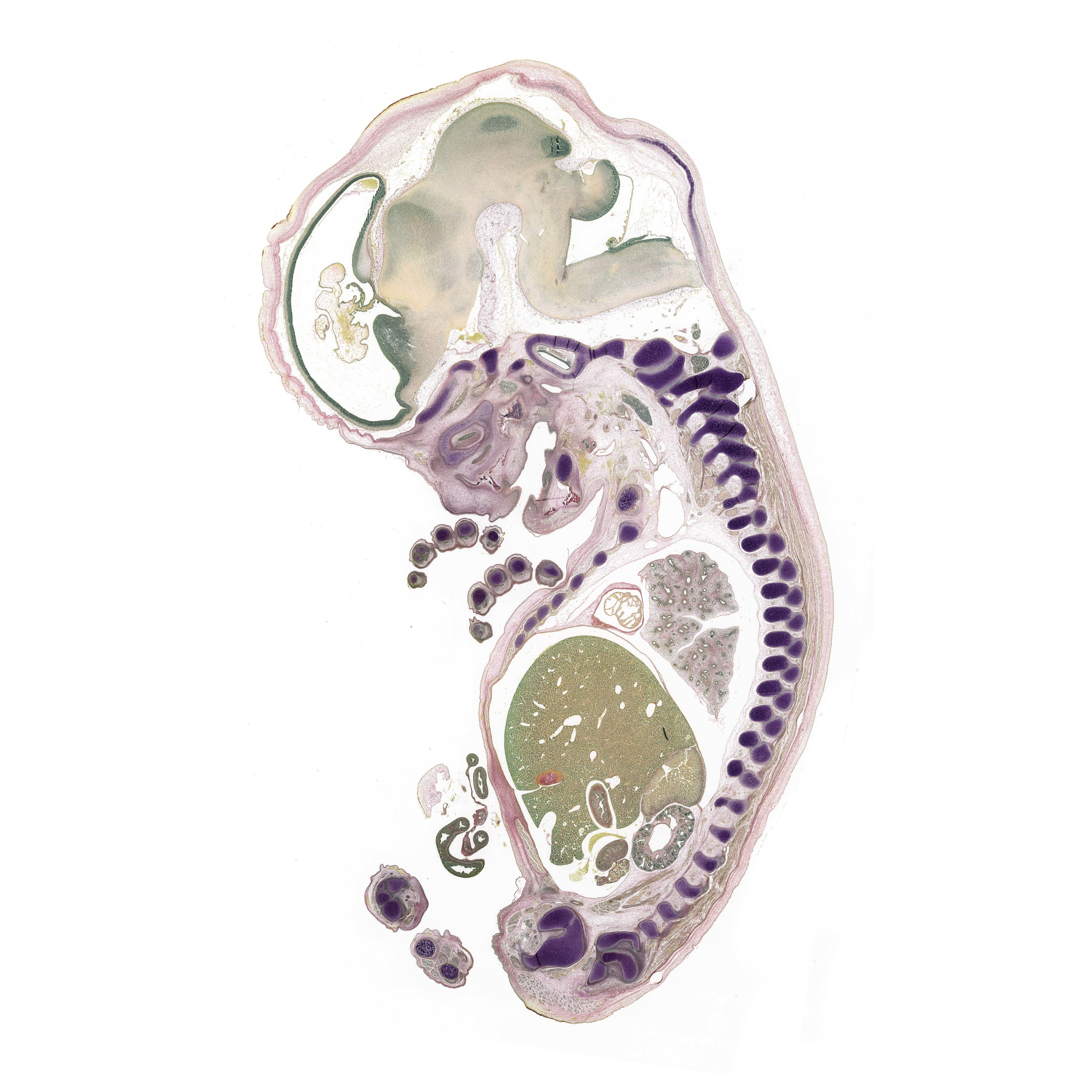 A pentachrome stained section of a human embryo