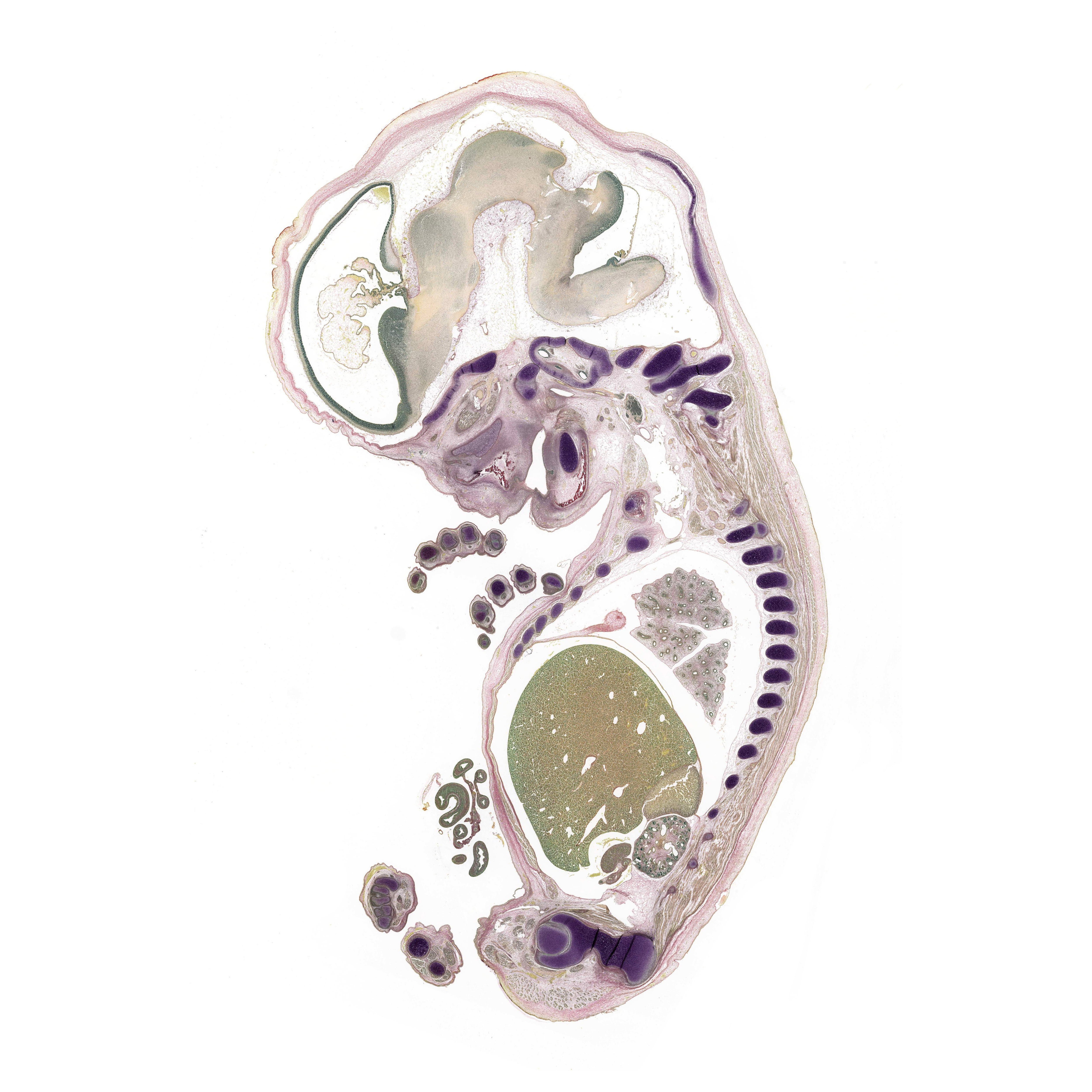 A pentachrome stained section of a human embryo