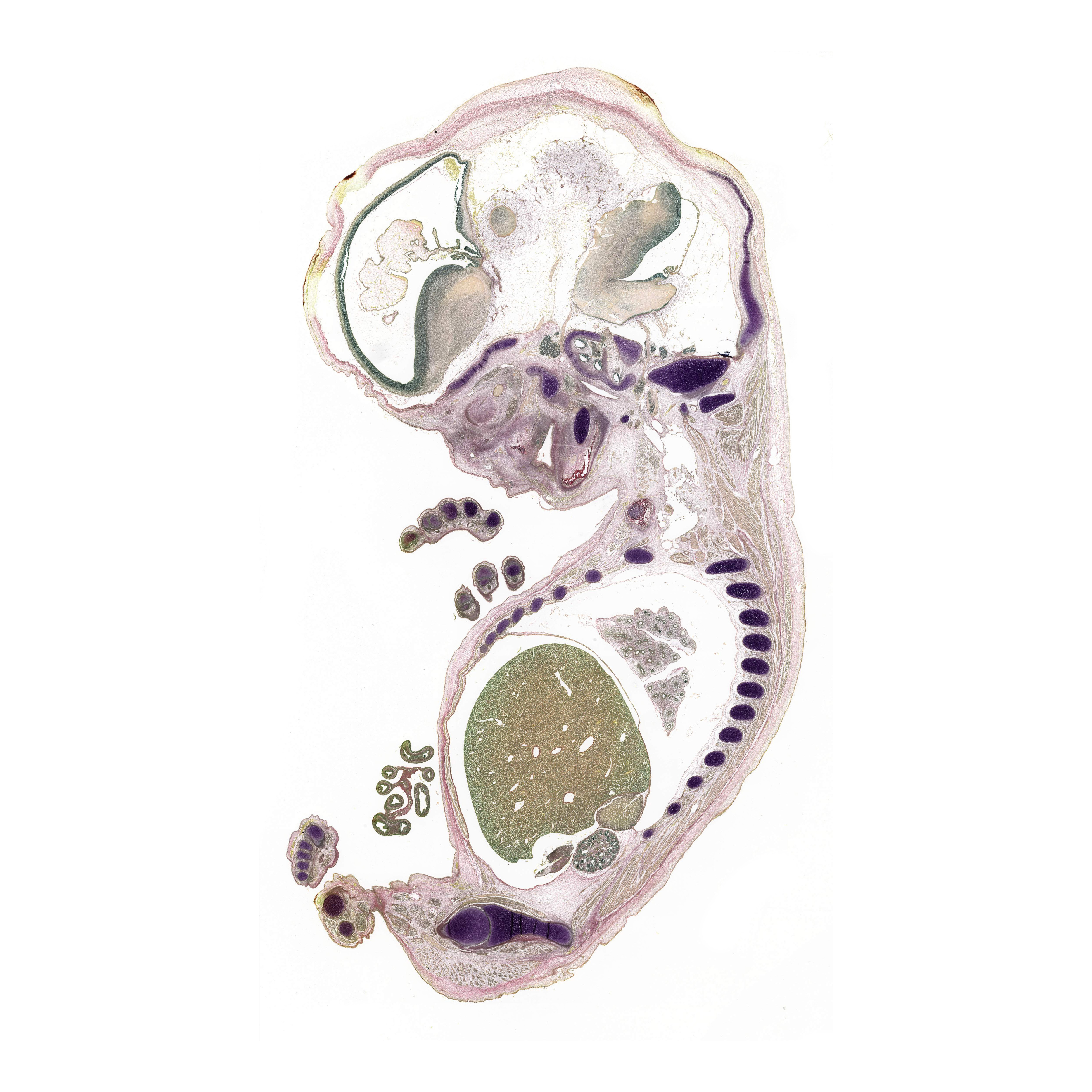A pentachrome stained section of a human embryo