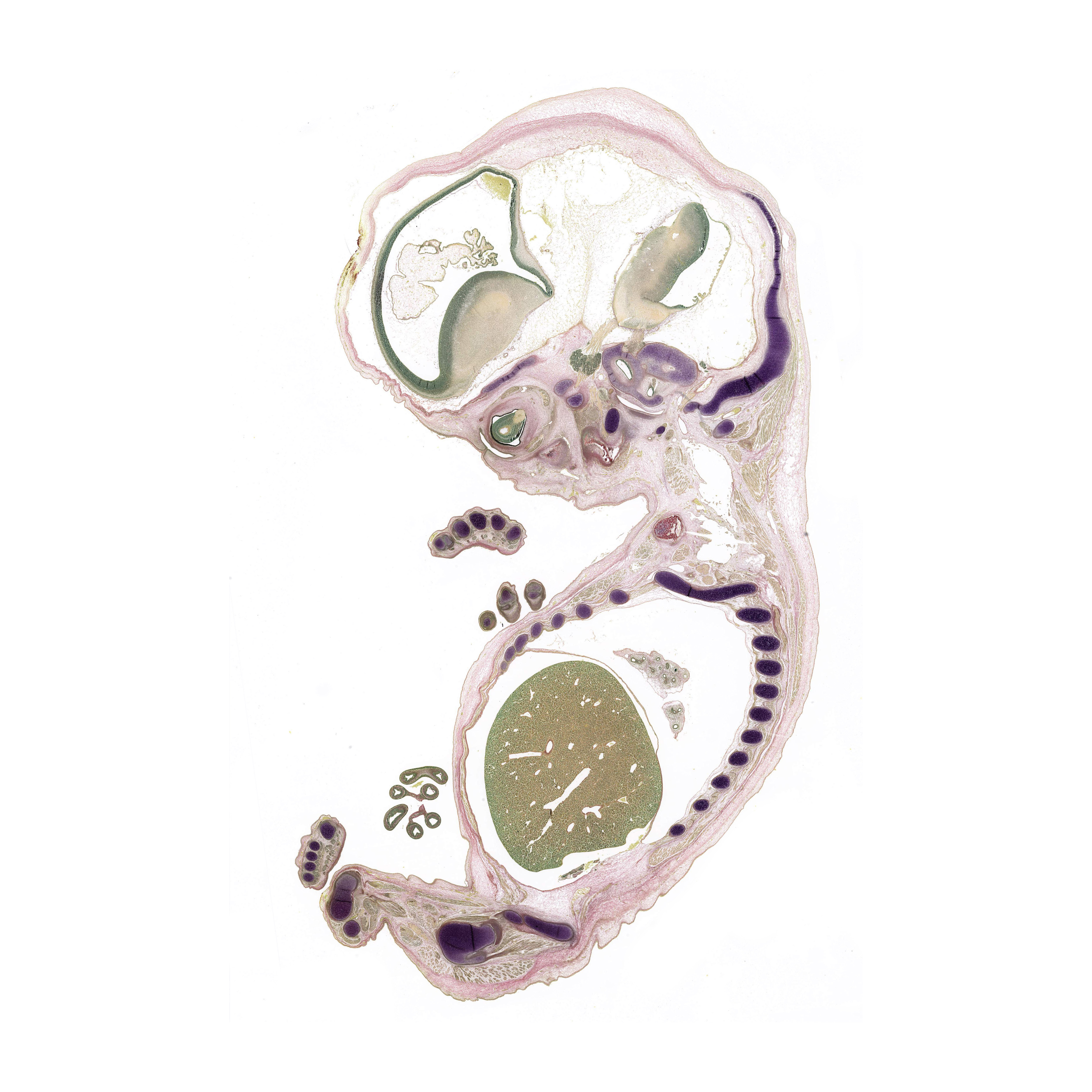 A pentachrome stained section of a human embryo