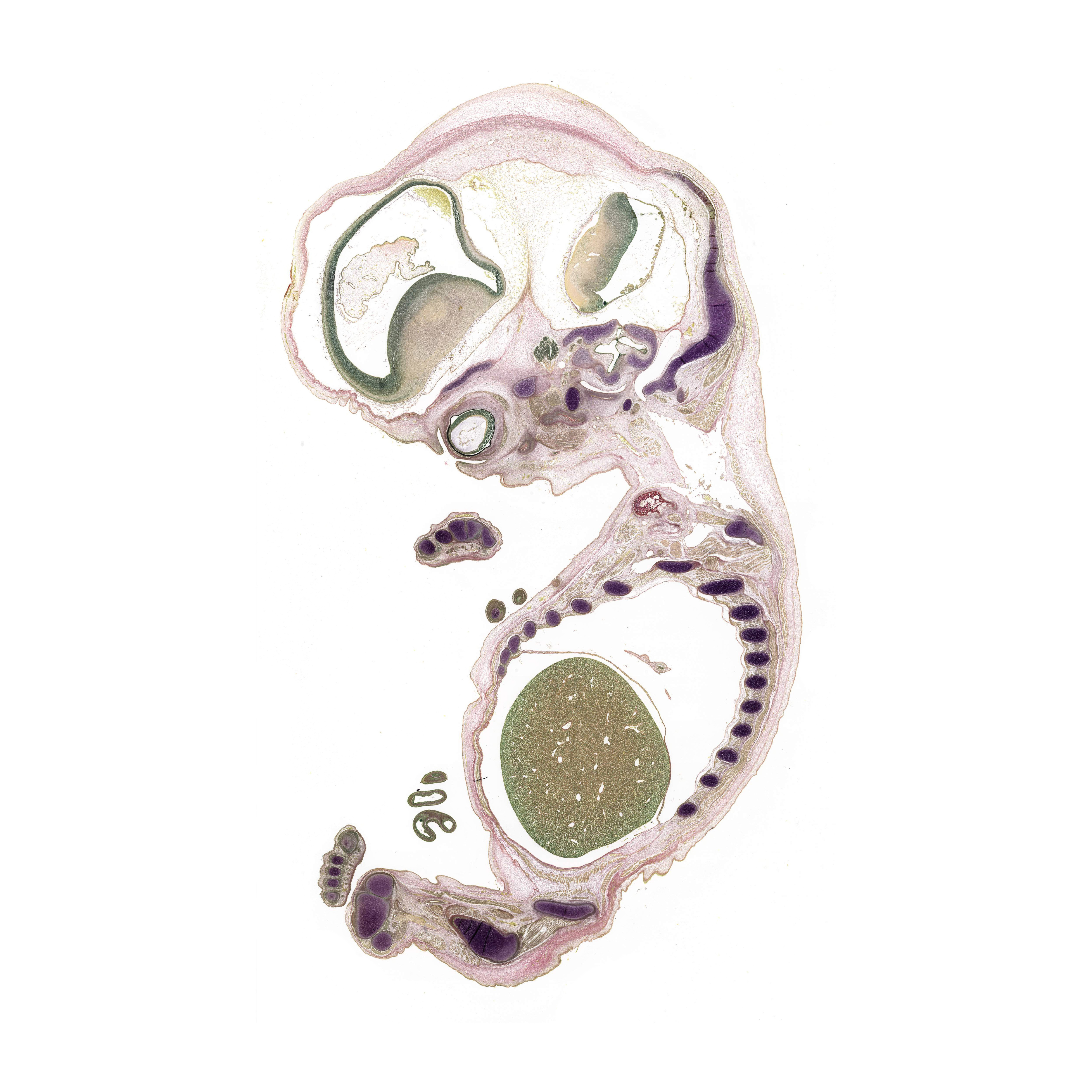 A pentachrome stained section of a human embryo