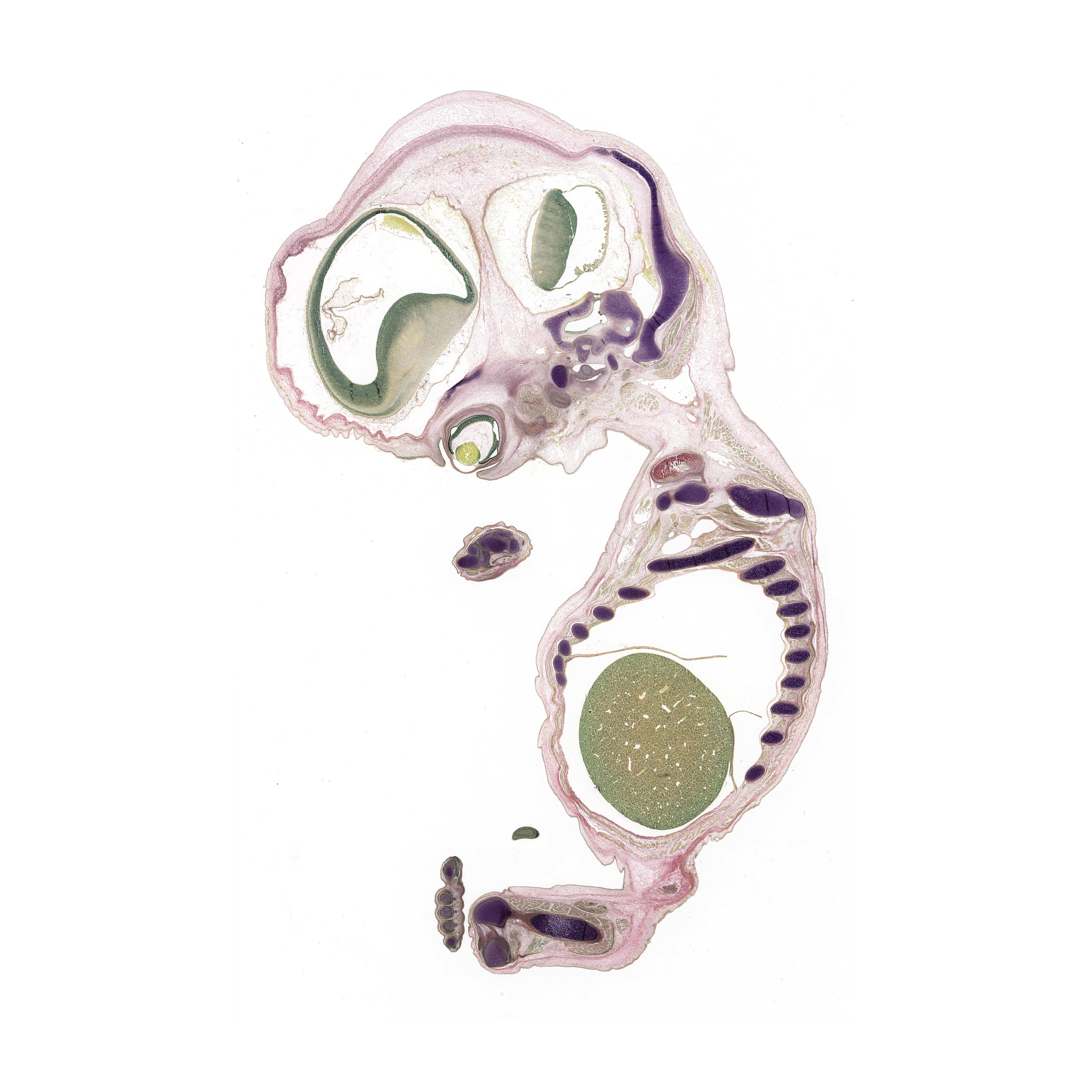 A pentachrome stained section of a human embryo