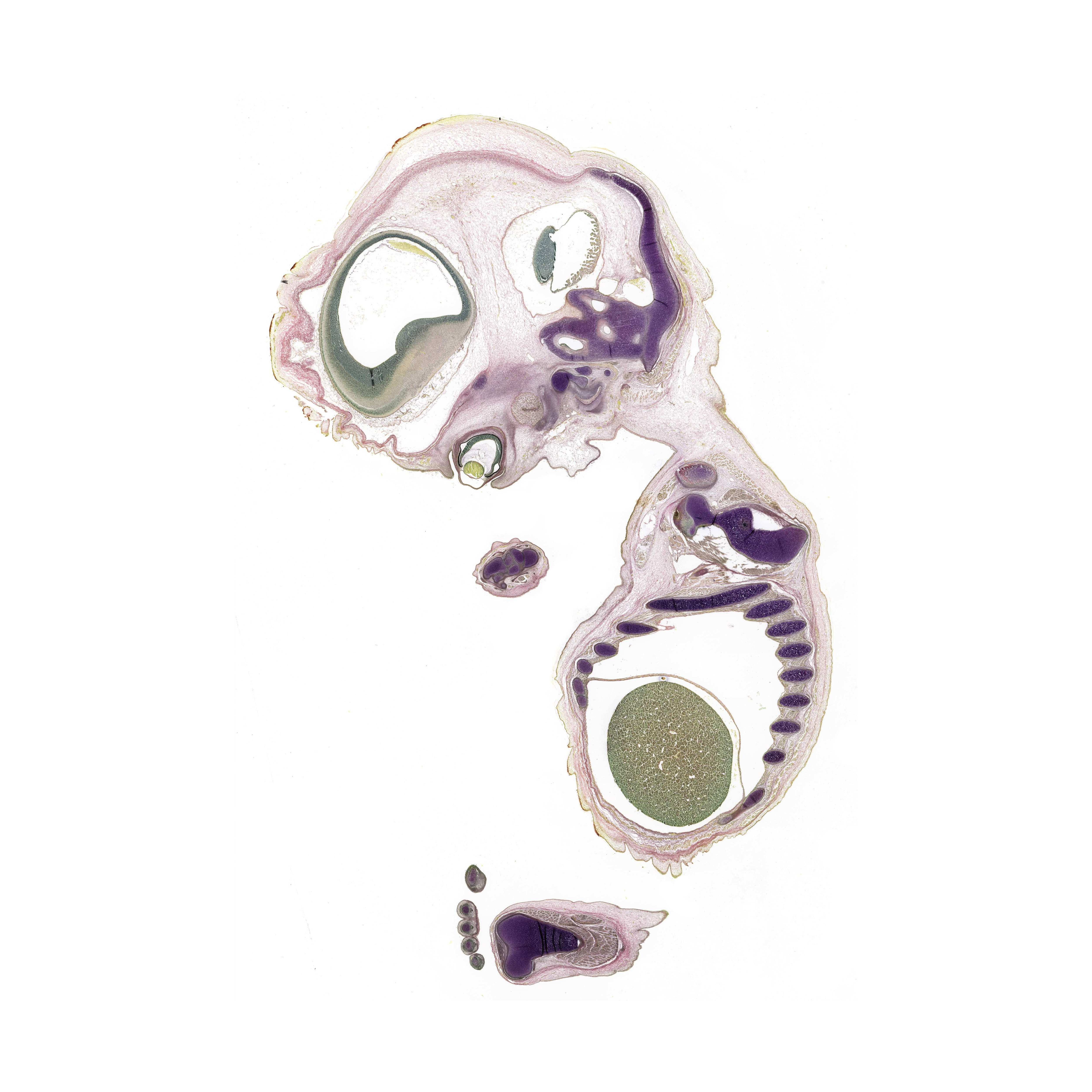 A pentachrome stained section of a human embryo