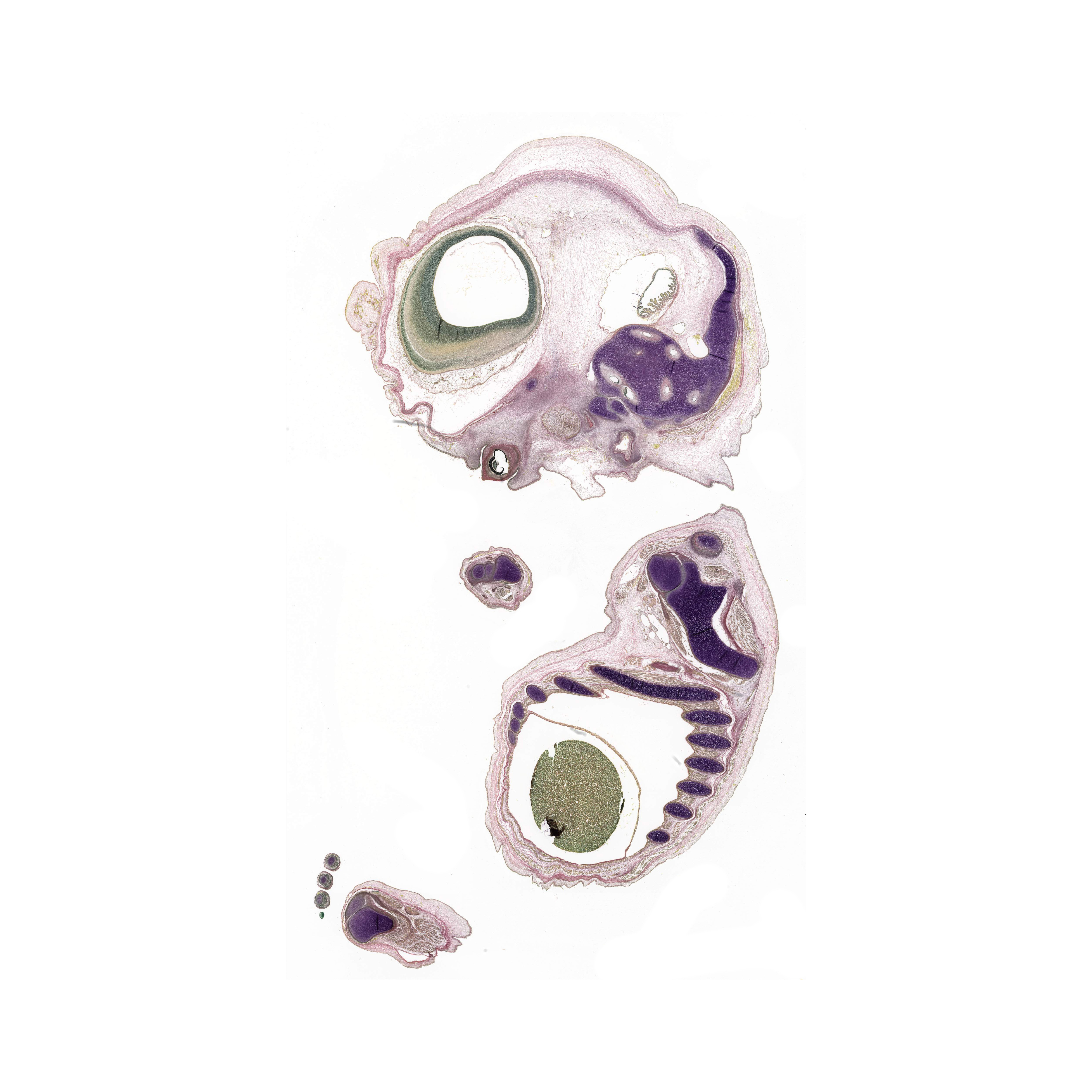 A pentachrome stained section of a human embryo