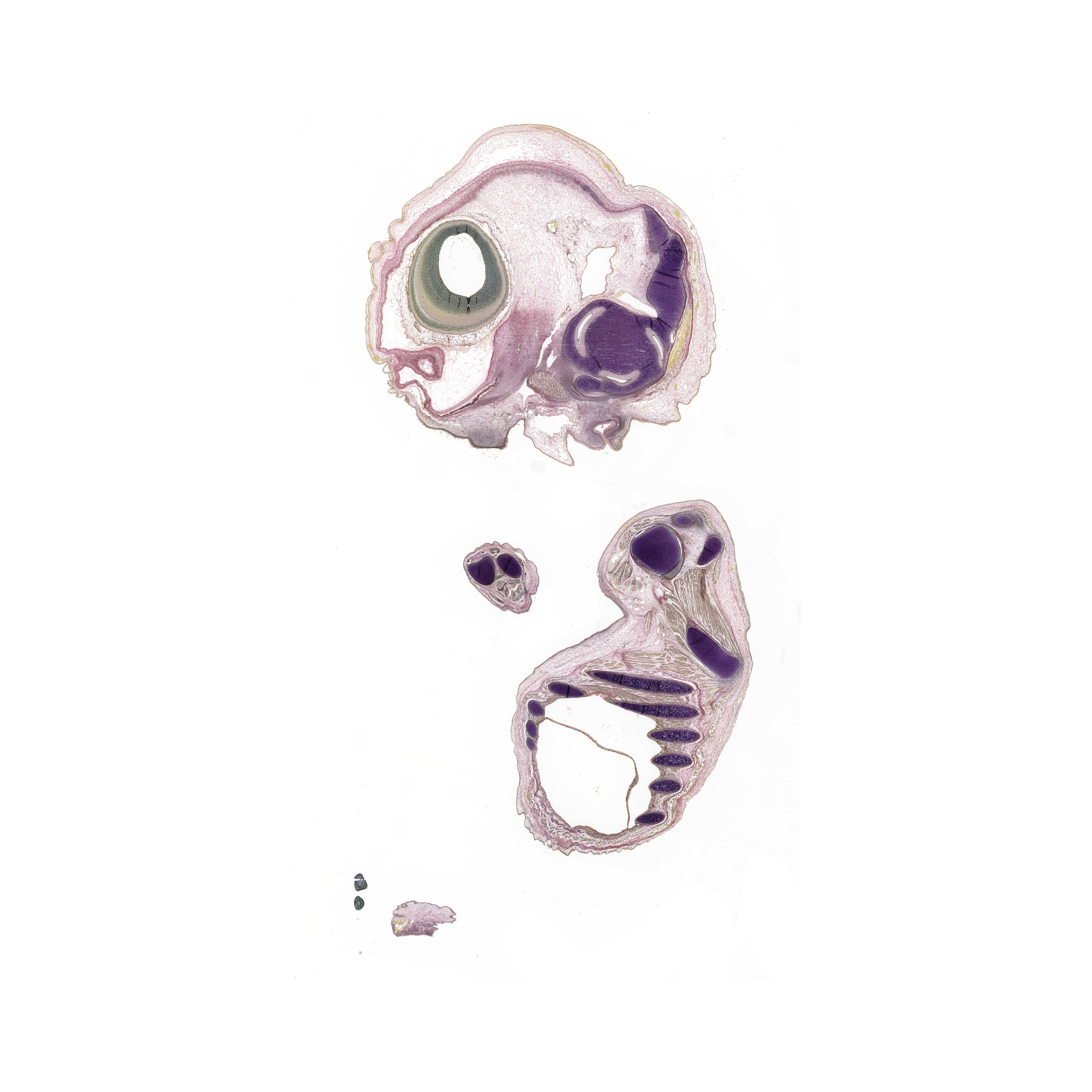 A pentachrome stained section of a human embryo