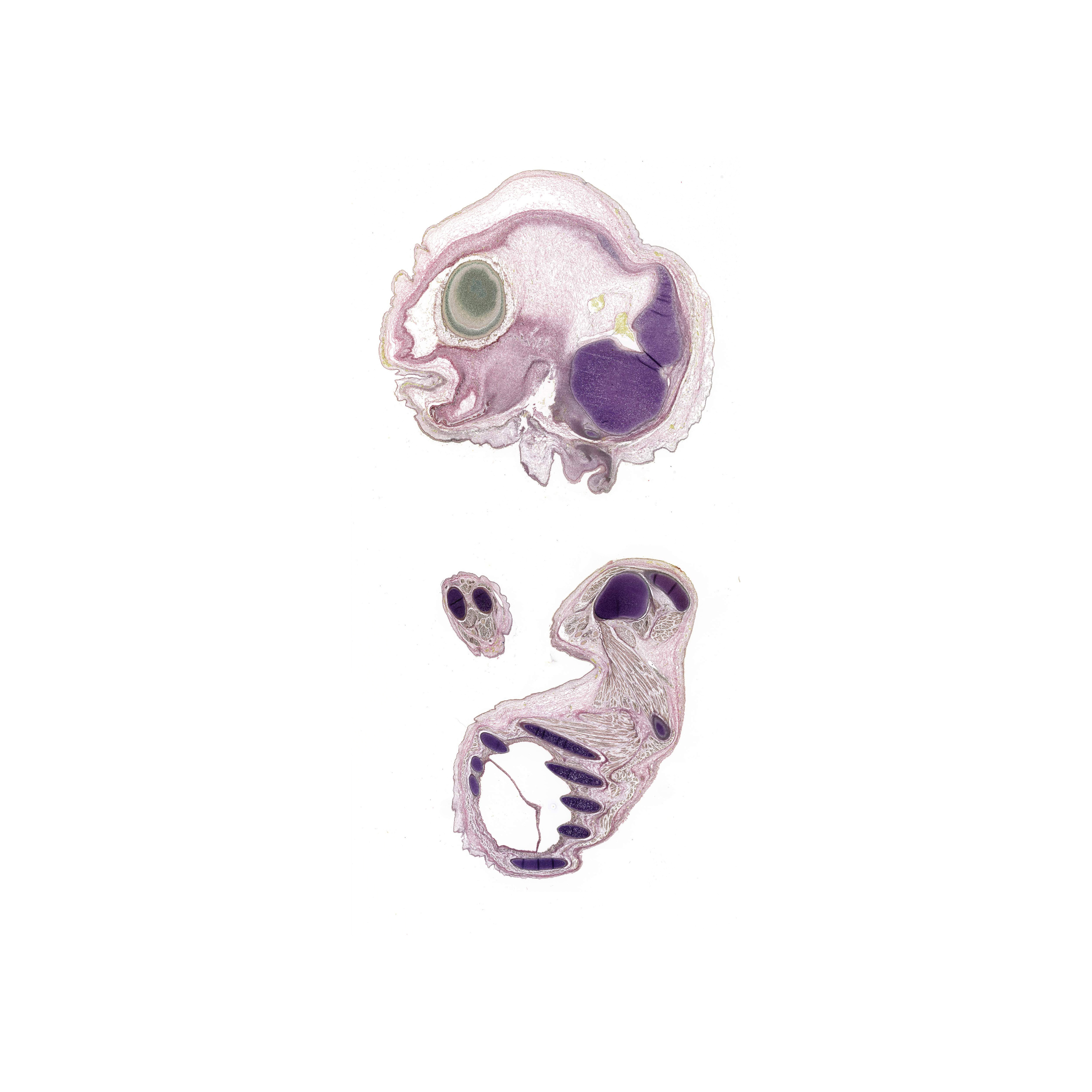 A pentachrome stained section of a human embryo