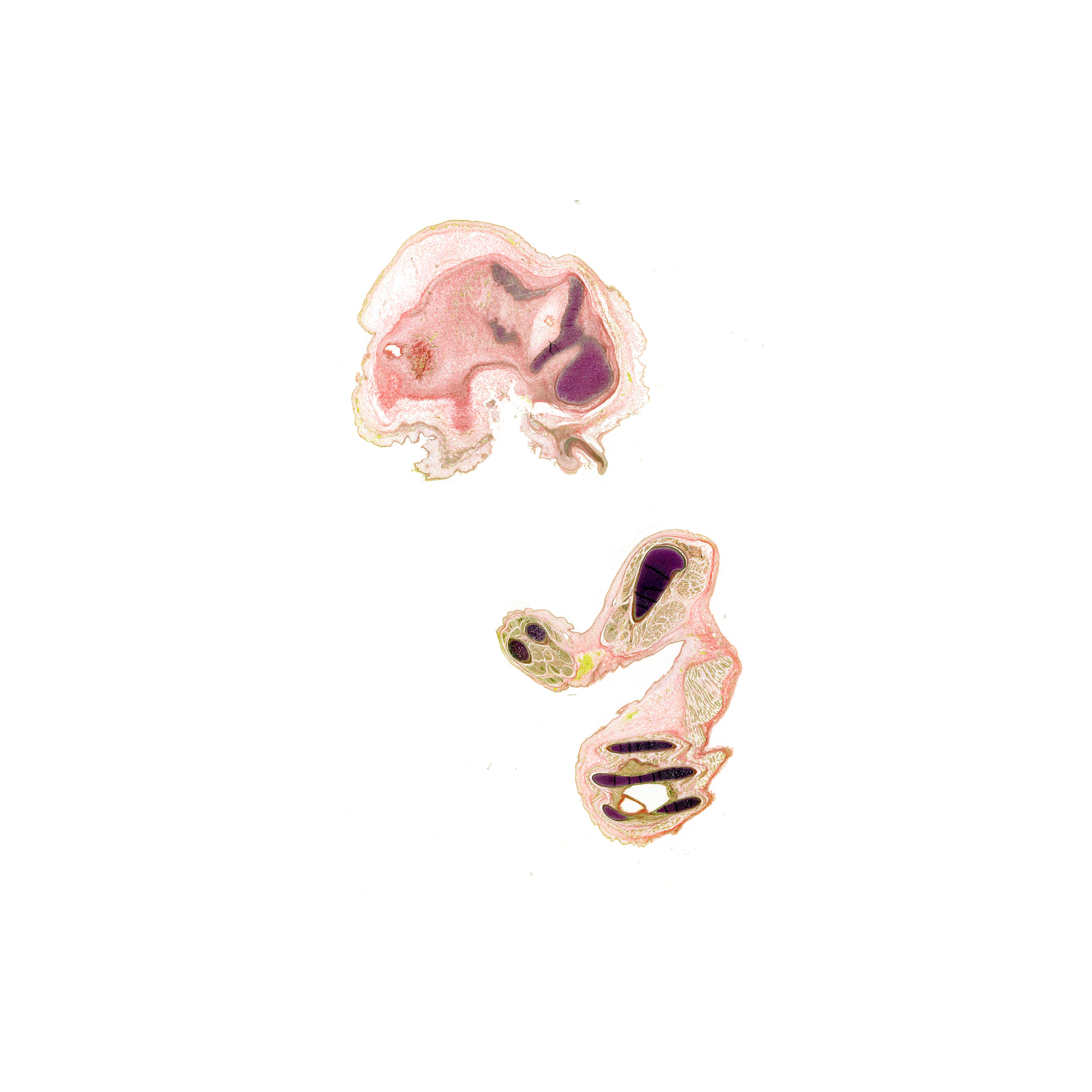 A pentachrome stained section of a human embryo