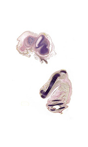 A pentachrome stained section of a human embryo
