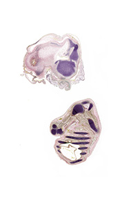 A pentachrome stained section of a human embryo