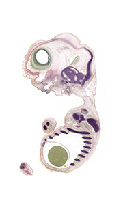 A pentachrome stained section of a human embryo
