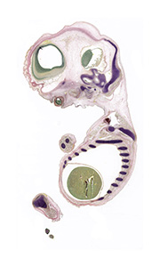 A pentachrome stained section of a human embryo