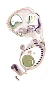 A pentachrome stained section of a human embryo