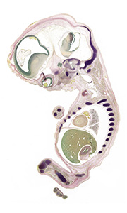 A pentachrome stained section of a human embryo