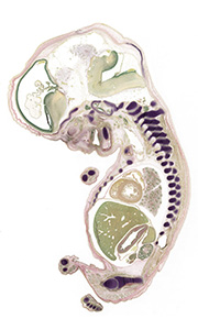 A pentachrome stained section of a human embryo