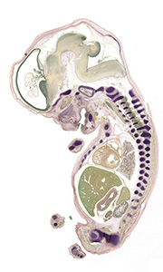A pentachrome stained section of a human embryo