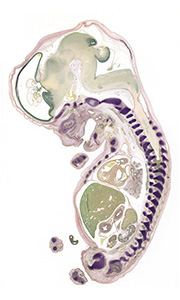 A pentachrome stained section of a human embryo