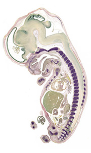 A pentachrome stained section of a human embryo