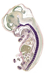 A pentachrome stained section of a human embryo