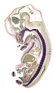 A pentachrome stained section of a human embryo