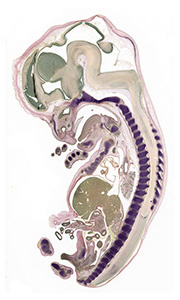 A pentachrome stained section of a human embryo