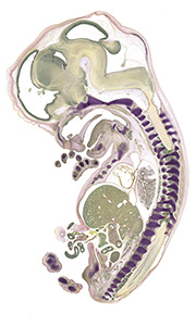 A pentachrome stained section of a human embryo