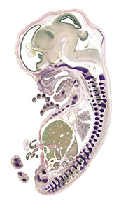 A pentachrome stained section of a human embryo