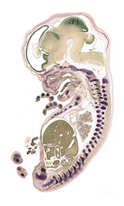 A pentachrome stained section of a human embryo