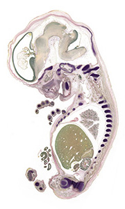 A pentachrome stained section of a human embryo