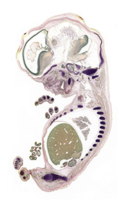 A pentachrome stained section of a human embryo