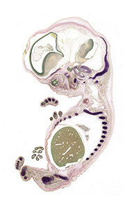 A pentachrome stained section of a human embryo