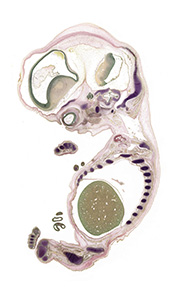 A pentachrome stained section of a human embryo