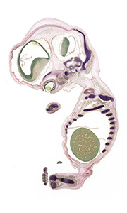 A pentachrome stained section of a human embryo