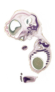 A pentachrome stained section of a human embryo