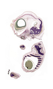 A pentachrome stained section of a human embryo