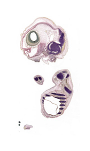 A pentachrome stained section of a human embryo