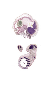 A pentachrome stained section of a human embryo