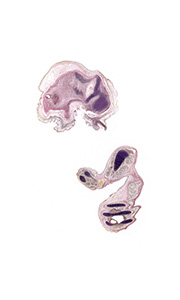 A pentachrome stained section of a human embryo