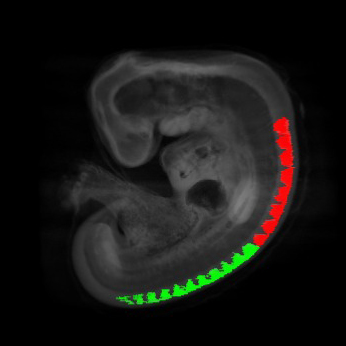 Human embryonic dorsal root ganglia