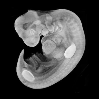 A 3D model of a human embryo Carnegie stage 14