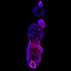 STX10 gene expression in a CS16 human embryonic heart