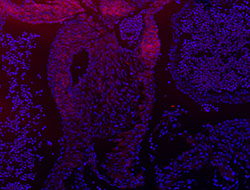 CRABP2 gene expression in a mouse embryonic heart