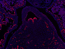 RBP1 gene expression in a mouse embryonic heart