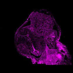 EIF2A gene expression in a CS16 human embryonic heart