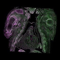 EIF2A and HOTAIR gene expression in a CS19 human embryonic heart