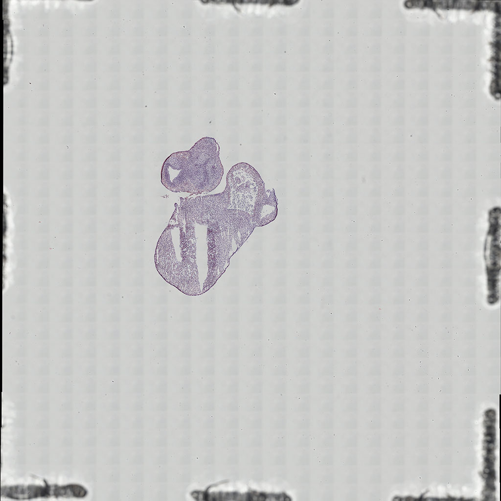 CS19 human embryonic heart ST section