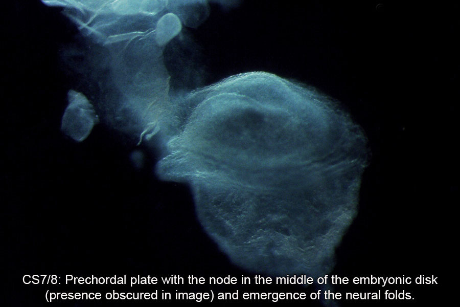 A human embryo, Carnegie Stage 7