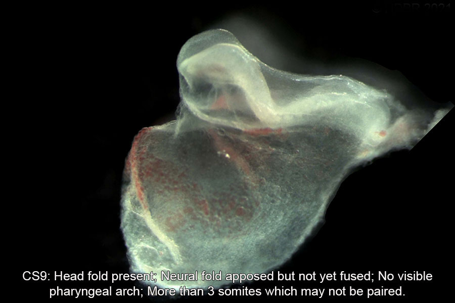 A human embryo, Carnegie Stage 9
