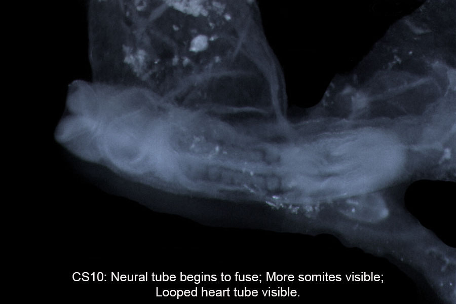 A human embryo, Carnegie Stage 10