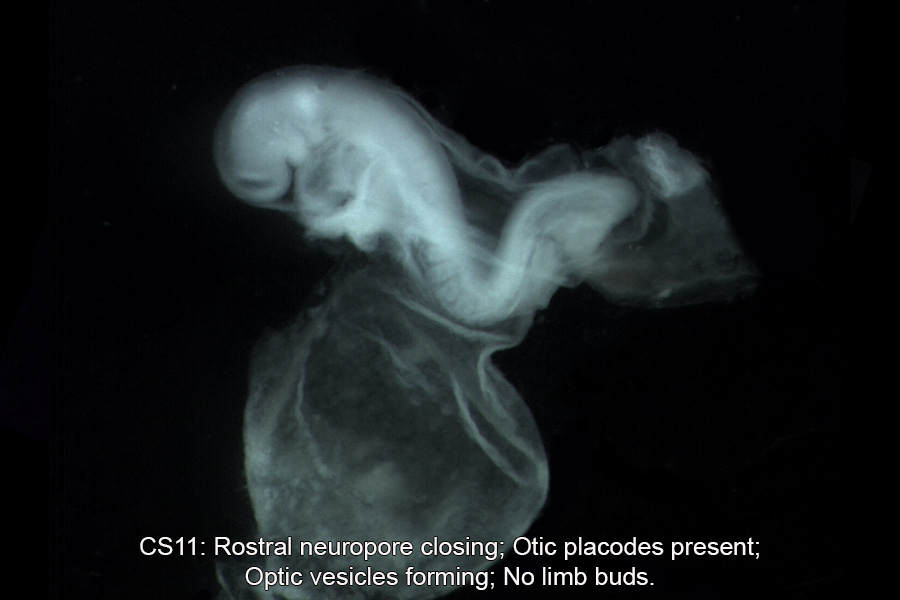 A human embryo, Carnegie Stage 11